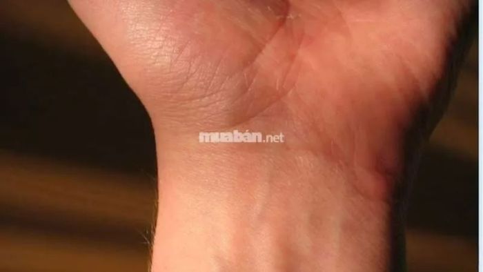 Vân chỉ tay chằng chịt ở cổ tay