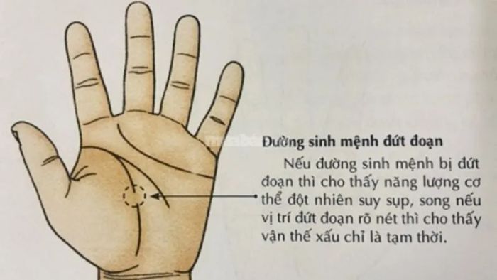 Đường chỉ tay sinh mệnh bị đứt gãy giữa chừng