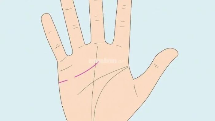 Đường tâm đạo bị đứt hoặc không có