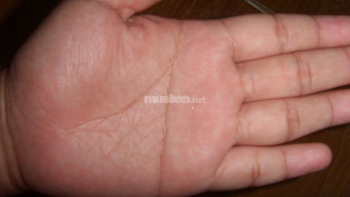 Nam giới sở hữu đường chỉ tay ngang ở tay trái mang ý nghĩa phúc tướng, báo hiệu một cuộc sống đầy hạnh phúc và thành công.
