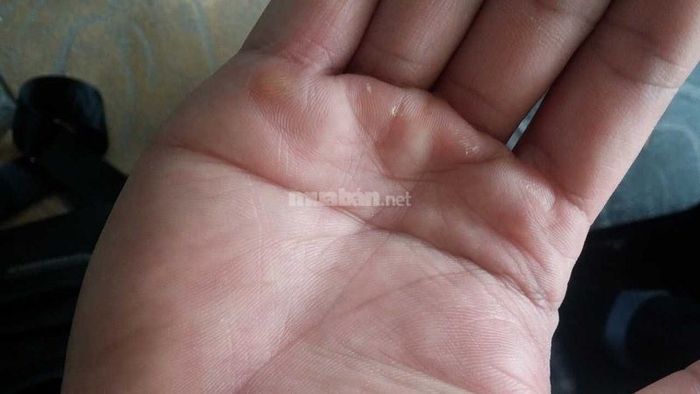 Đặc điểm đường chỉ tay ngang ở nam giới