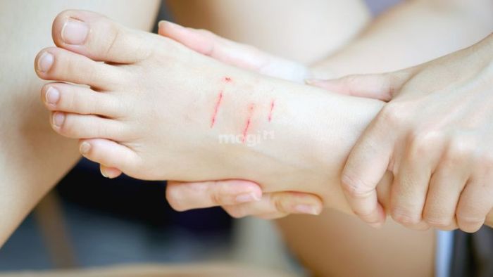 Giấc mơ bị mèo cào có thể là dấu hiệu cho thấy có ai đó đang ghen tị với bạn và có thể tạo ra khó khăn trong công việc của bạn.
