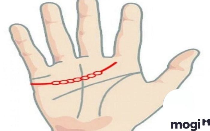 Đường chỉ tay mắt xích