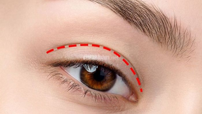 Nhấn mí là một kỹ thuật làm đẹp phổ biến nhờ khả năng tạo ra nếp mí tự nhiên mà không cần phẫu thuật.