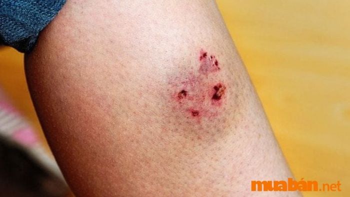 Mơ thấy chó cắn nhưng không có máu chảy