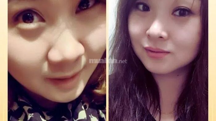 Mũi củ tỏi ở phụ nữ có những đặc điểm nổi bật trong nhân tướng học.
