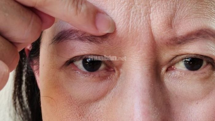 Tình trạng lão hóa cũng có thể làm thay đổi hình dáng lông mày, khiến chúng dễ dựng ngược hơn.