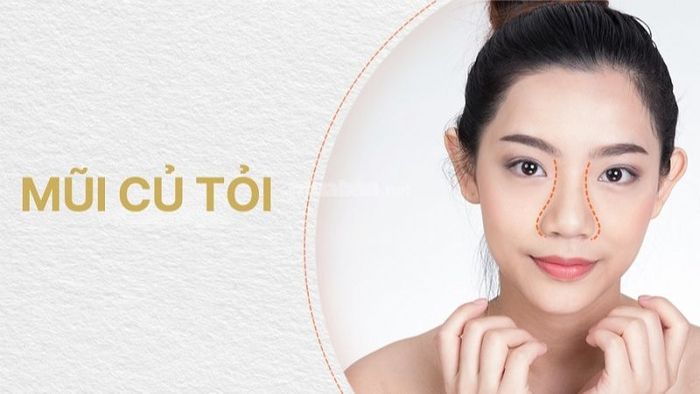 Mũi củ tỏi là gì?