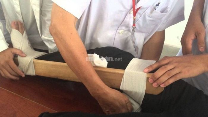 Mơ Thấy Tai Nạn Gãy Chân, Gãy Tay