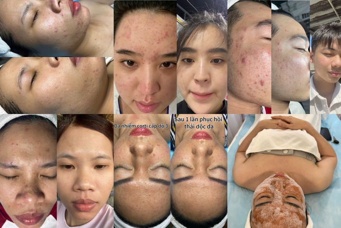 spa chat luong Vung Tau 2.png