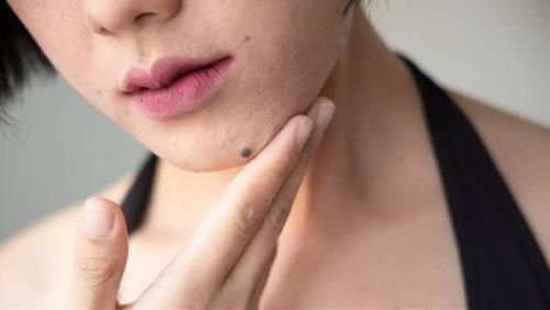Bói tính cách 12 cung hoàng đạo qua vị trí nốt ruồi
