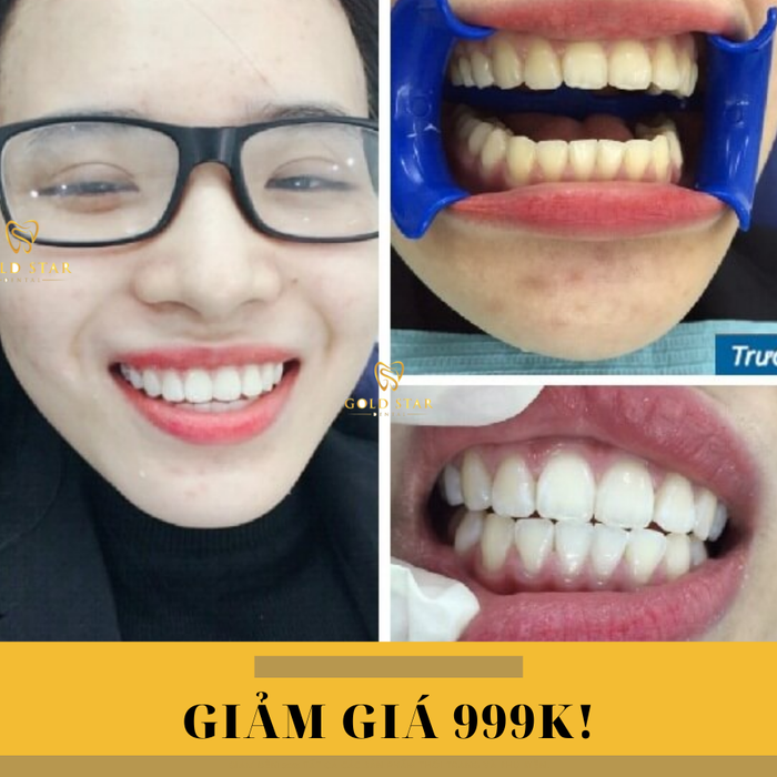 Hình ảnh Nha Khoa Gold Star