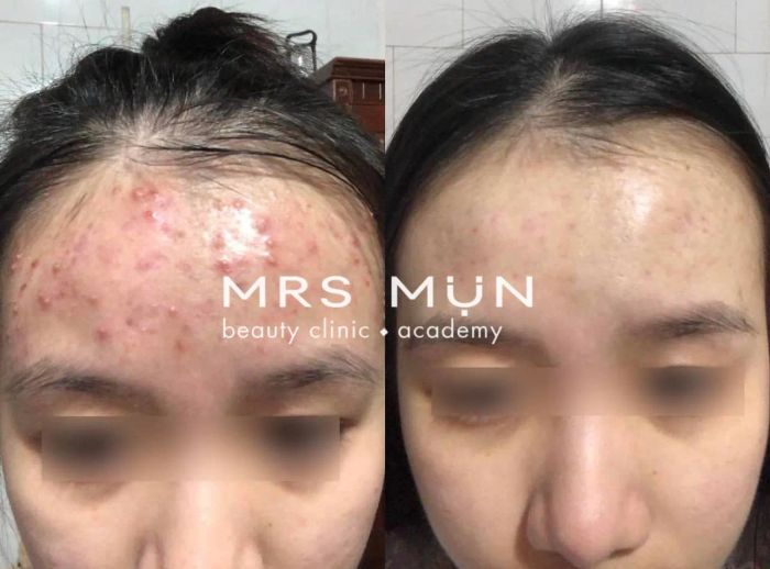 Hình ảnh không gian sang trọng tại Mrs Mụn Beauty Clinic & Academy