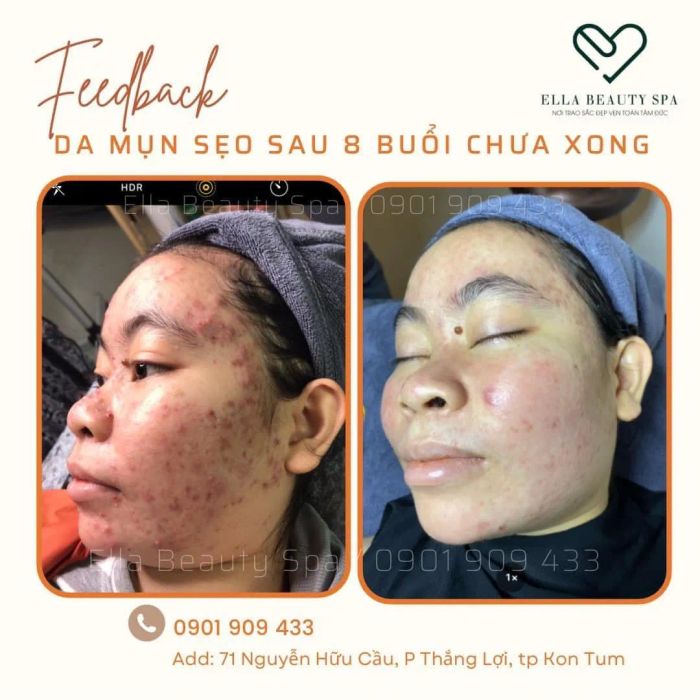 Khám phá không gian sang trọng tại ELLA BEAUTY SPA qua những hình ảnh đẹp mắt - nơi kết hợp hoàn hảo giữa thẩm mỹ và nghệ thuật