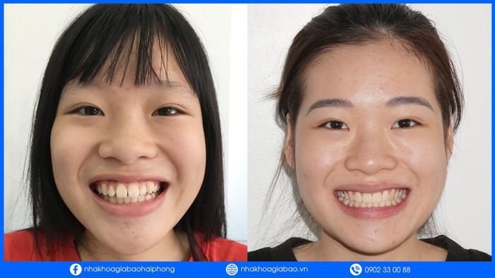 Không gian hiện đại tại Nha Khoa Gia Bảo