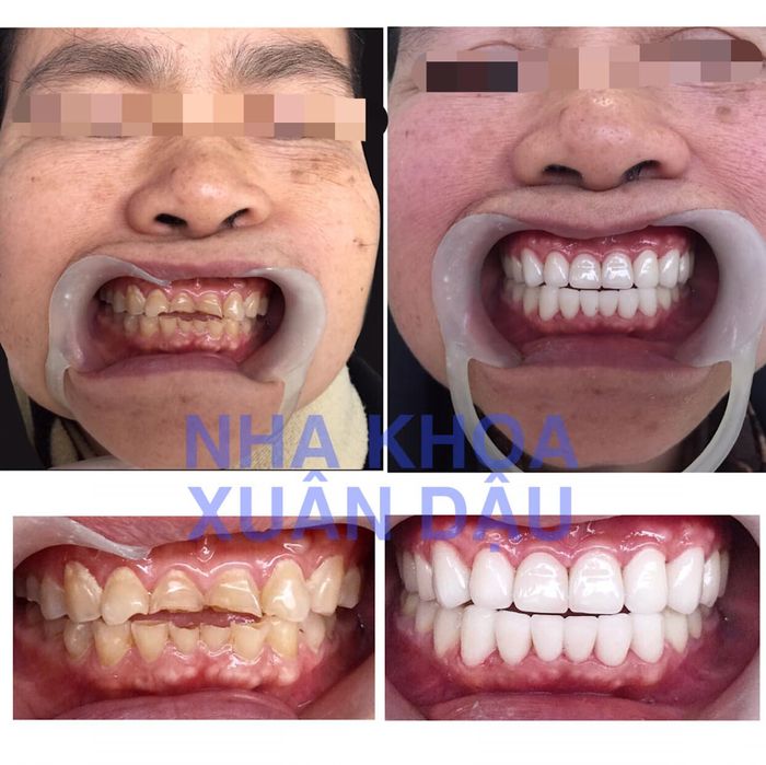 Phòng điều trị cao cấp tại Nha Khoa Xuân Dậu