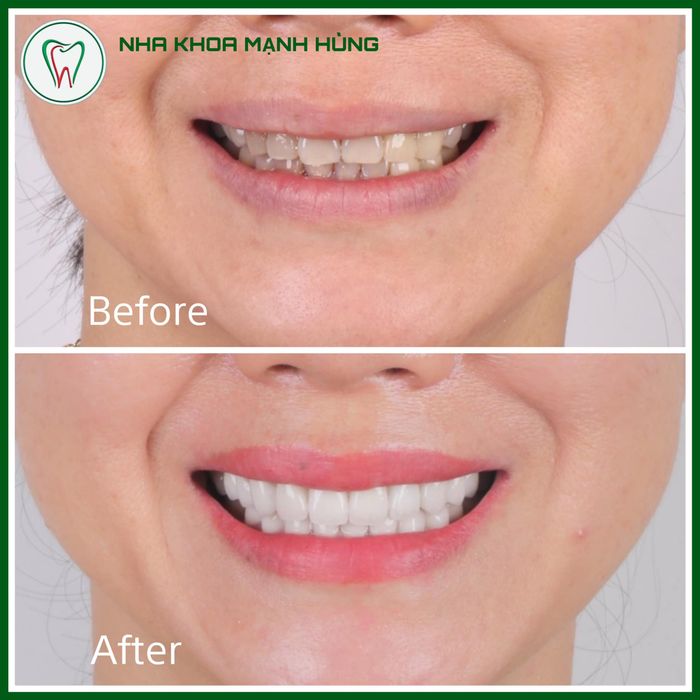 Không gian phòng khám hiện đại tại Nha Khoa Mạnh Hùng