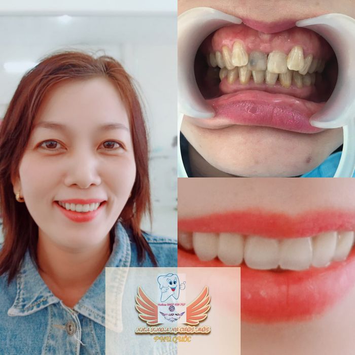 Không gian hiện đại tại Nha Khoa Nụ Cười Mới Phú Quốc