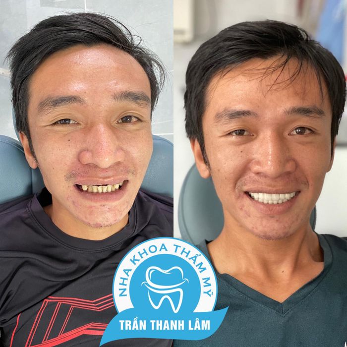 Hệ thống máy móc tân tiến tại Nha Khoa Trần Thanh Lâm