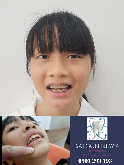 Không gian hiện đại tại Nha Khoa Sài Gòn New 4 Phú Quốc