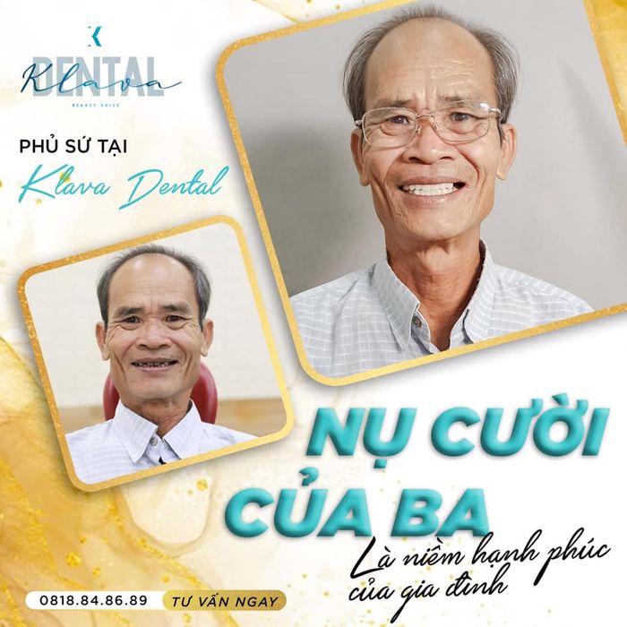 Không gian hiện đại tại KLAVA Smart Dental