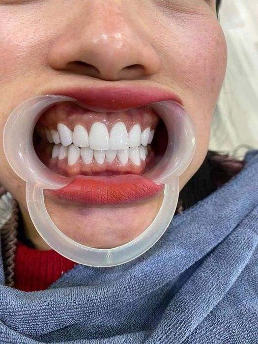 Hệ thống trang thiết bị tân tiến của Nha Khoa Sài Gòn New 4