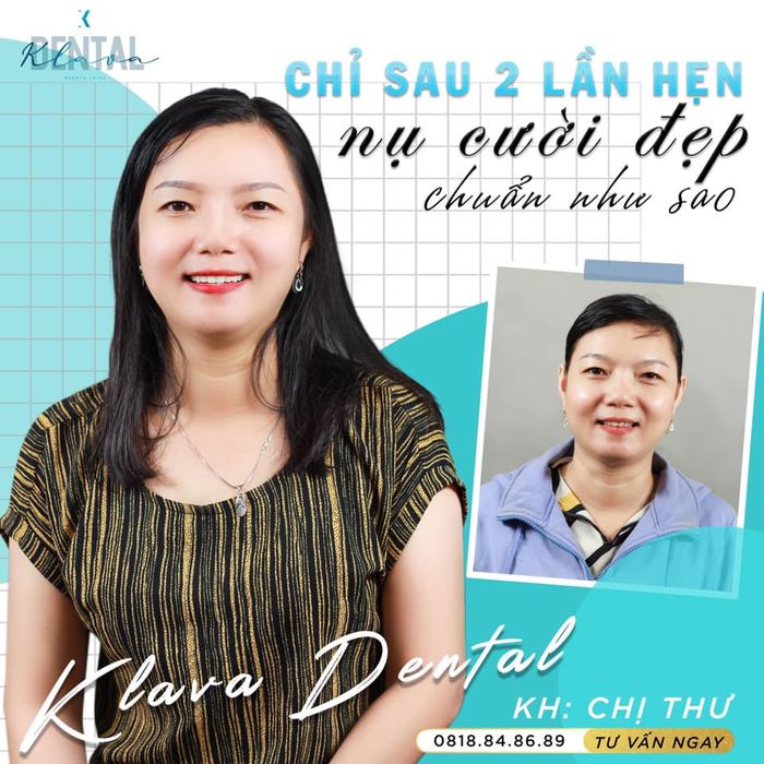 Hệ thống máy móc tân tiến tại KLAVA Smart Dental