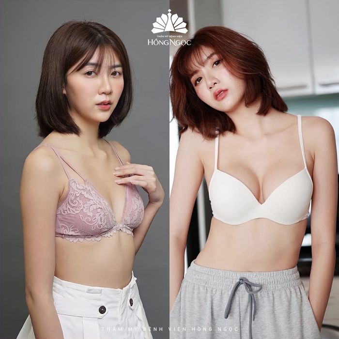 Thẩm Mỹ Bệnh Viện Hồng Ngọc - Hệ thống phòng mổ hiện đại