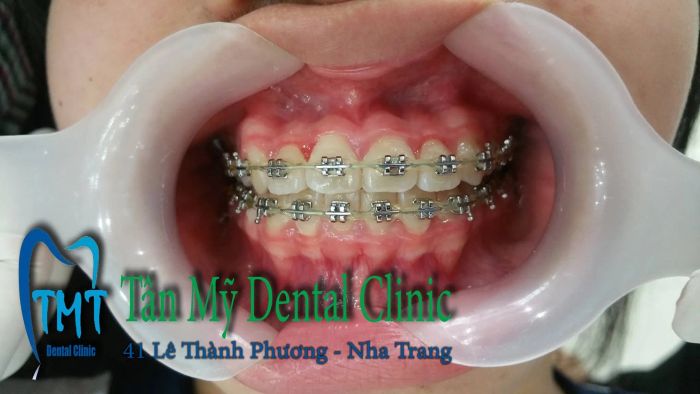 Hình ảnh đội ngũ bác sĩ chuyên nghiệp tại Nha Khoa Tân Mỹ