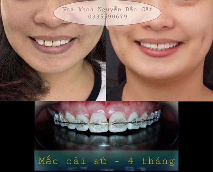 Hình ảnh 2 - Nha khoa Nguyễn Đắc Cật tại Nha Trang