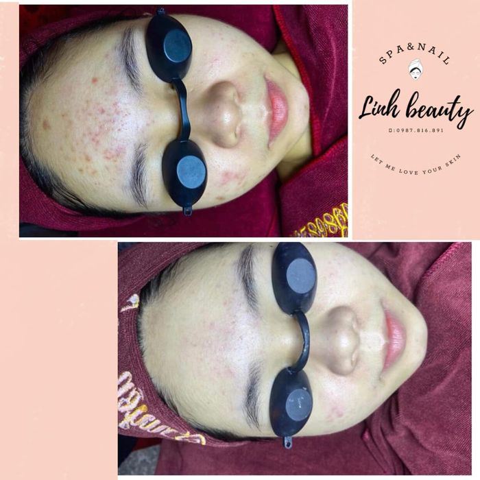Không gian sang trọng và hiện đại tại Linh Beauty Spa