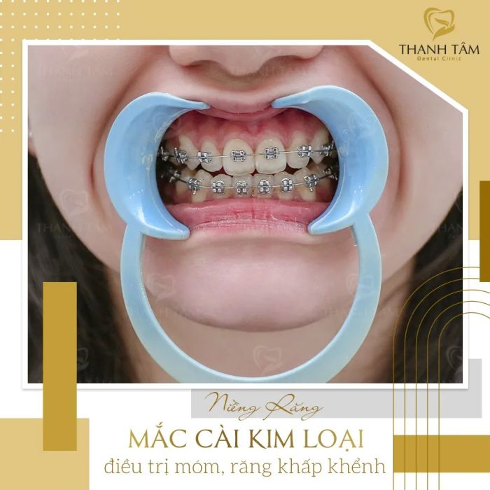 Hình ảnh thực tế về không gian hiện đại tại Nha Khoa Thanh Tâm