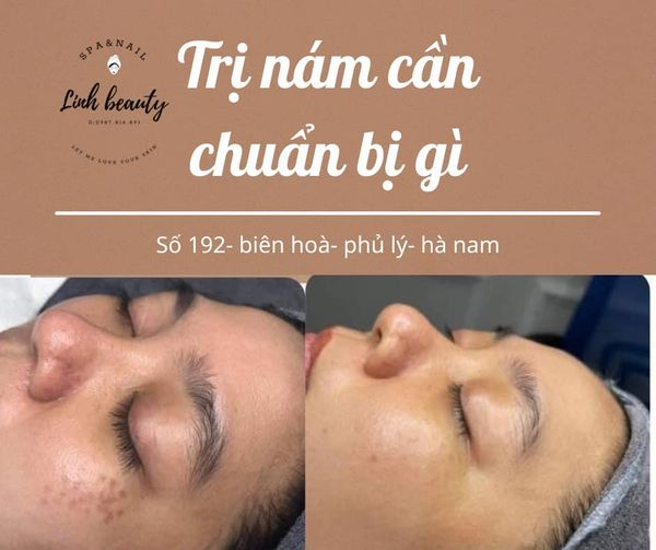 Hình ảnh quy trình trị liệu chuyên nghiệp tại Linh Beauty Spa