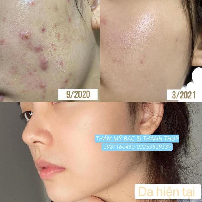 Hình ảnh ấn tượng về Thẩm mỹ viện Bác Sĩ Thành Thủy