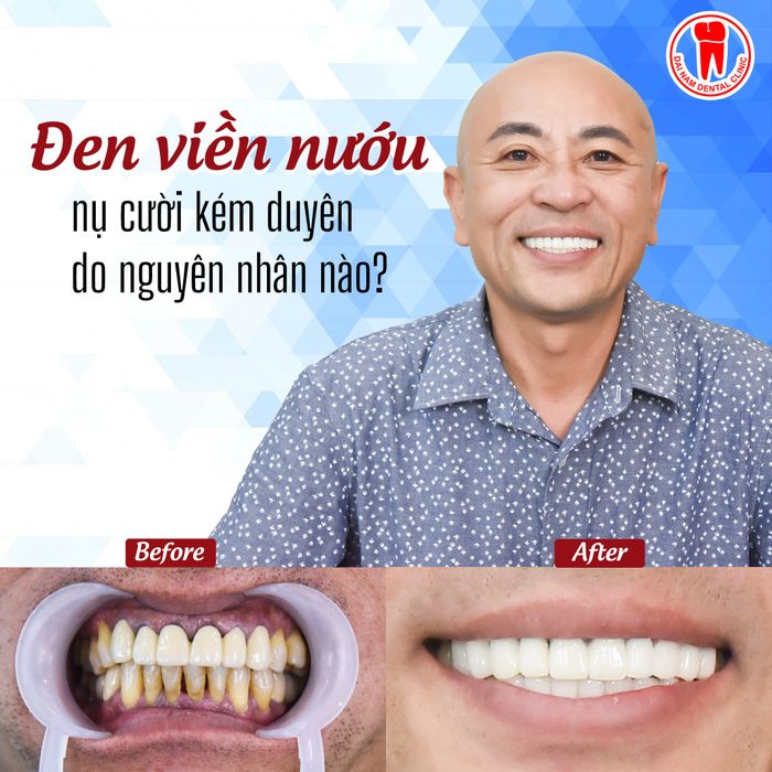 Hình ảnh thực tế tại Nha Khoa Đại Nam
