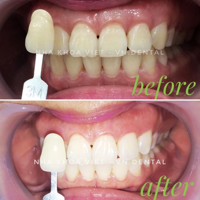 Không gian hiện đại và tiện nghi tại Nha Khoa Việt Plus