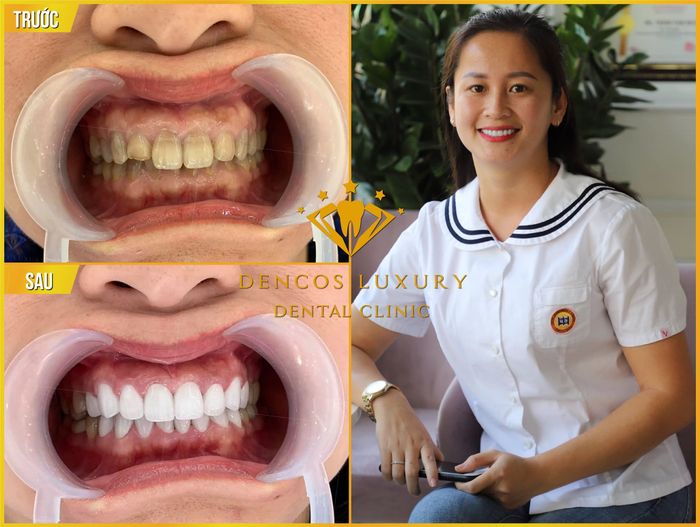 Không gian sang trọng đạt chuẩn quốc tế tại Dencos Luxury