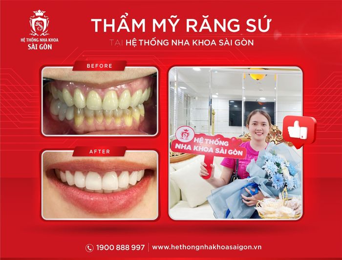 Hình ảnh hệ thống phòng khám đạt chuẩn tại Hệ Thống Nha Khoa Sài Gòn