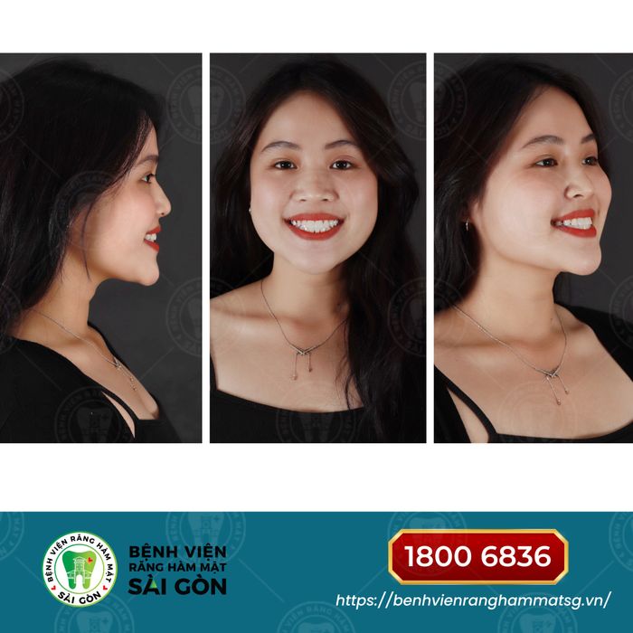 Hình ảnh không gian hiện đại tại Răng Hàm Mặt Sài Gòn - Mỹ Tho