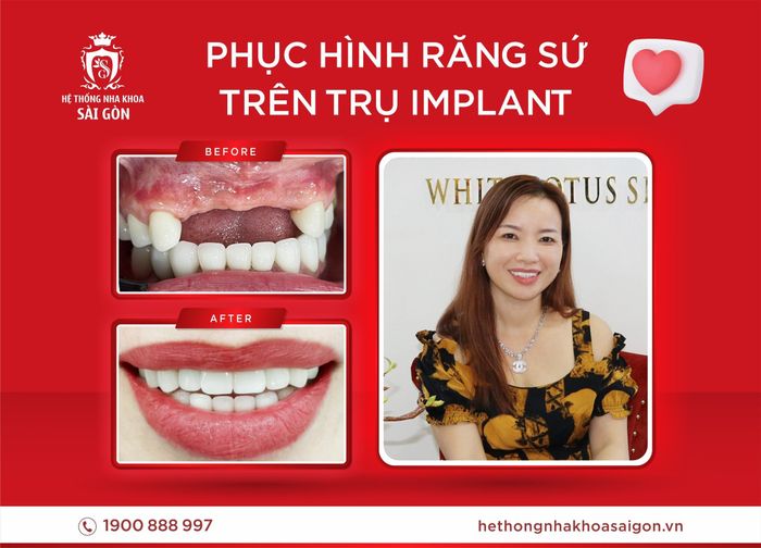 Hình ảnh đội ngũ y bác sĩ chuyên môn cao tại Hệ Thống Nha Khoa Sài Gòn
