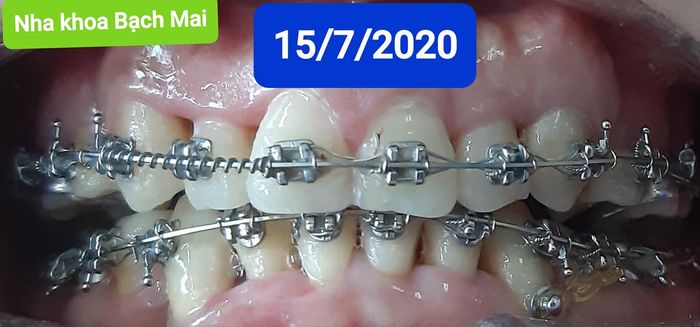 Hình ảnh cơ sở vật chất hiện đại tại Nha khoa Bạch Mai