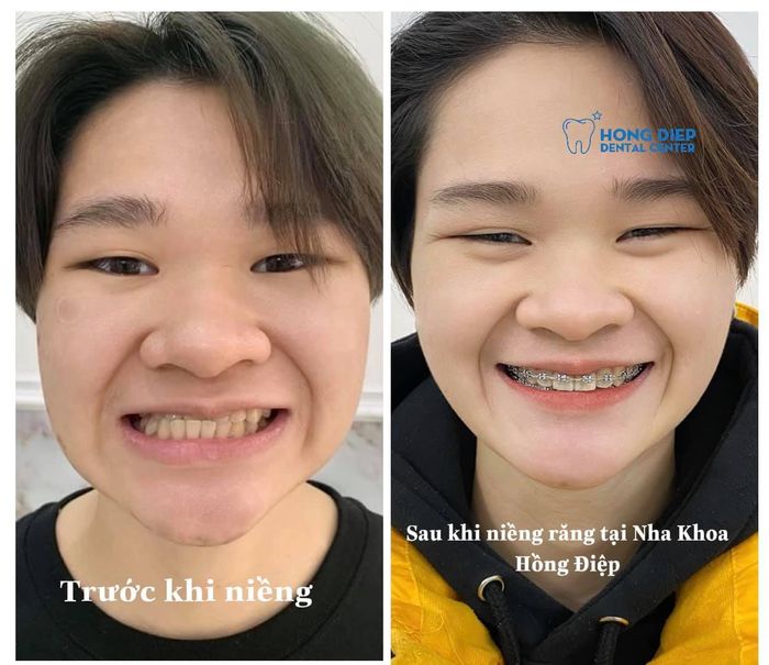 Hình ảnh thực tế Nha khoa Hồng Điệp - Không gian hiện đại, tiện nghi