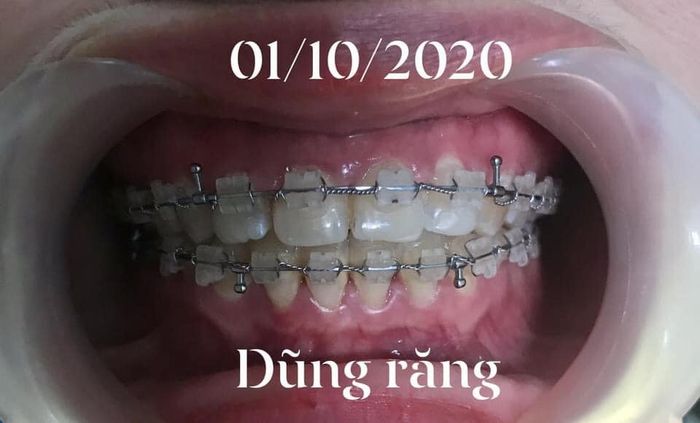 Hình ảnh cơ sở vật chất hiện đại tại Nha Khoa Hà Nội