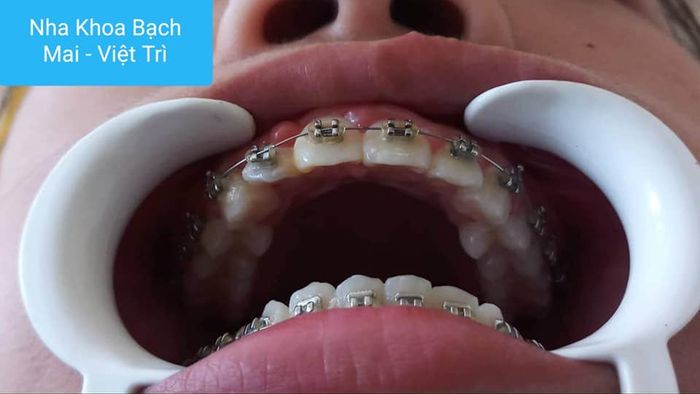 Hình ảnh đội ngũ bác sĩ chuyên môn cao tại Nha khoa Bạch Mai