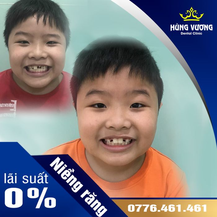 Hình ảnh Nha Khoa Hùng Vương Việt Trì - Cơ sở vật chất hiện đại, tiện nghi