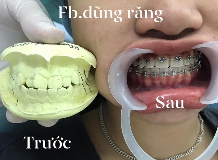 Hình ảnh không gian hiện đại tại Nha Khoa Hà Nội