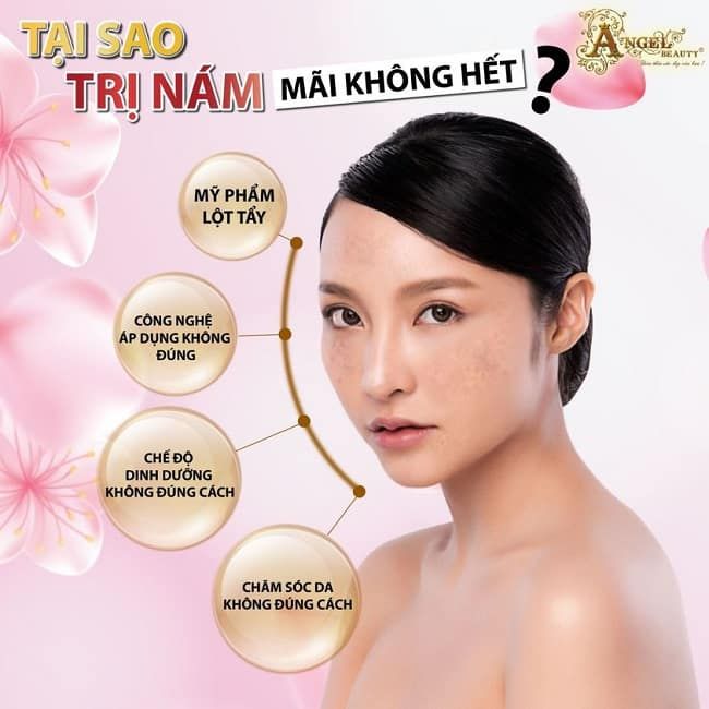 Angelbeauty - Giải pháp trị nám tận gốc