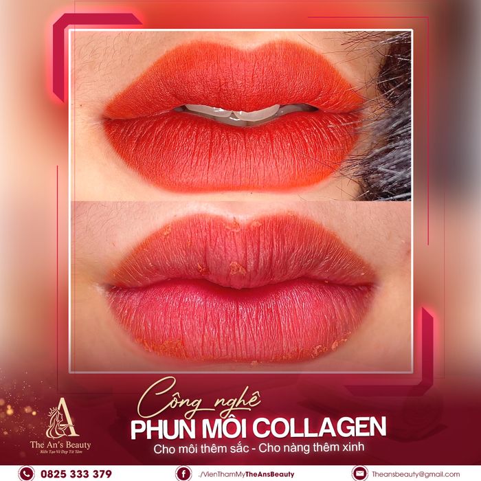 Hình ảnh trải nghiệm dịch vụ đẳng cấp tại Viện Thẩm Mỹ The An's