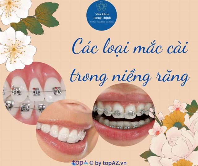 Nha khoa Hưng Thịnh - Đẳng cấp dịch vụ, chuẩn mực quốc tế