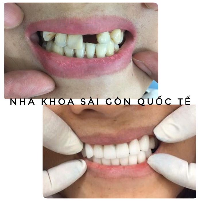 Hình ảnh cơ sở vật chất hiện đại tại Nha Khoa Sài Gòn Quốc Tế Phan Thiết